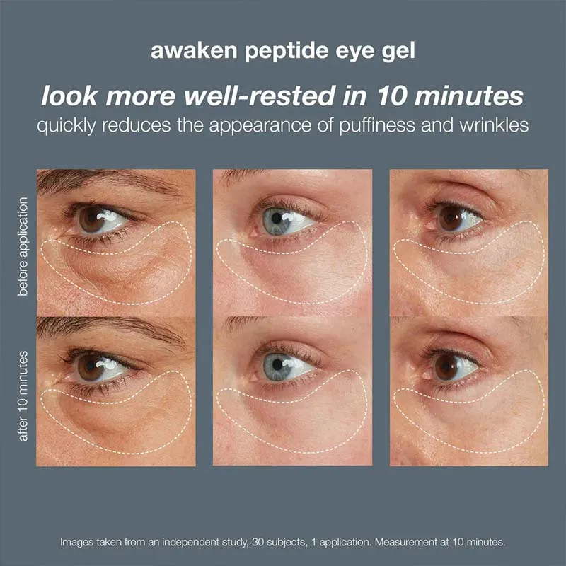 Dermalogica Awaken Peptide Eye Gel Discontinued
